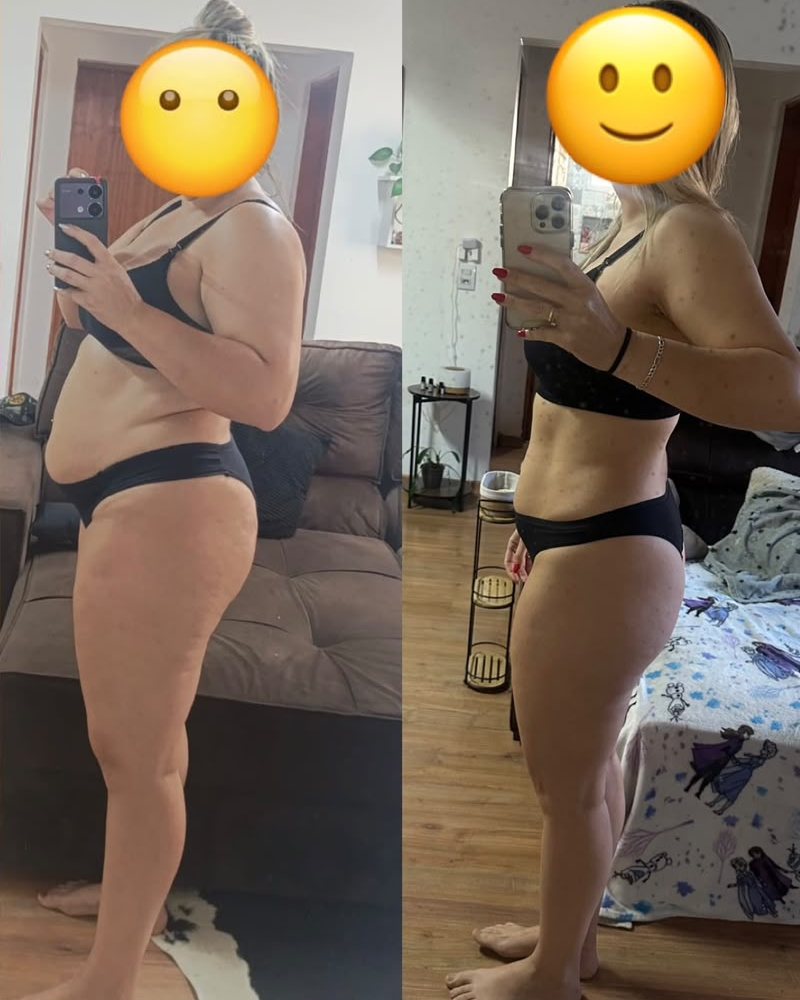 Aluna do Desafio Guia da Nutri de perfil, antes e depois, com o rosto coberto